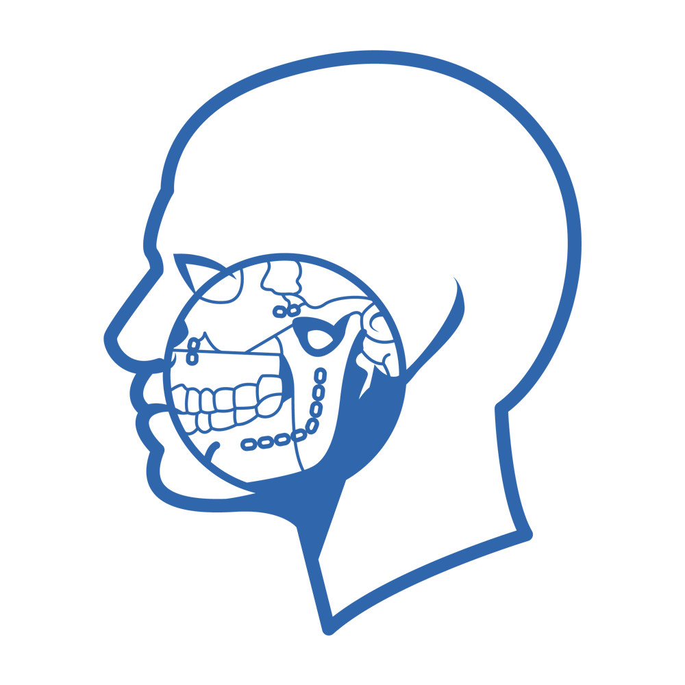 Facial injury
